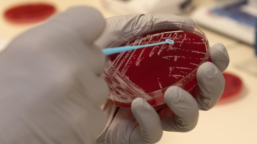 Photo of Strep culture by U.S. Air Force Photo by Heide Couch)